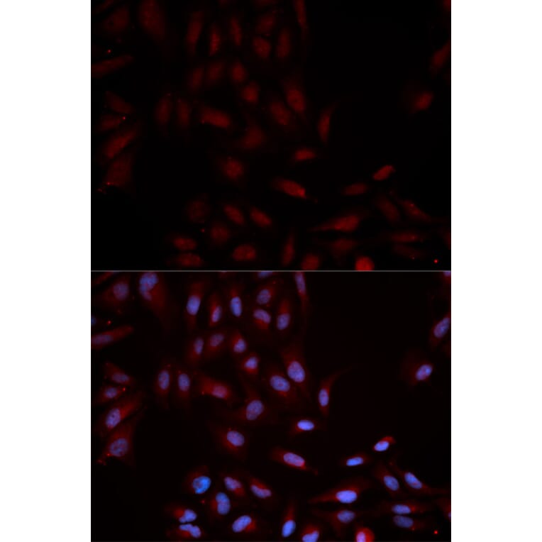 Immunofluorescence - Anti-MAPK14 (phospho Y322) Antibody (AP0055) - Antibodies.com