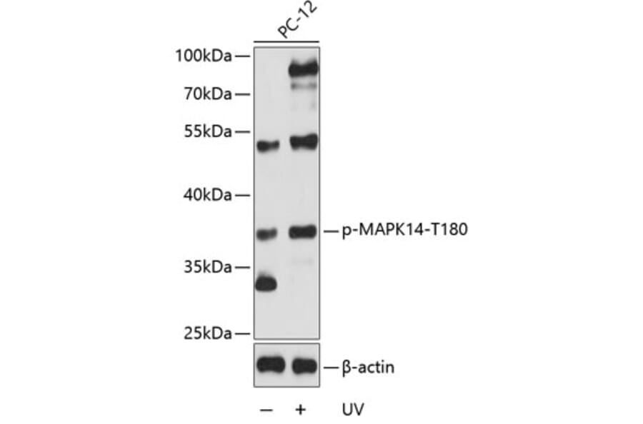 Western Blot - Anti-MAPK14 (phospho T180) Antibody (AP0056) - Antibodies.com