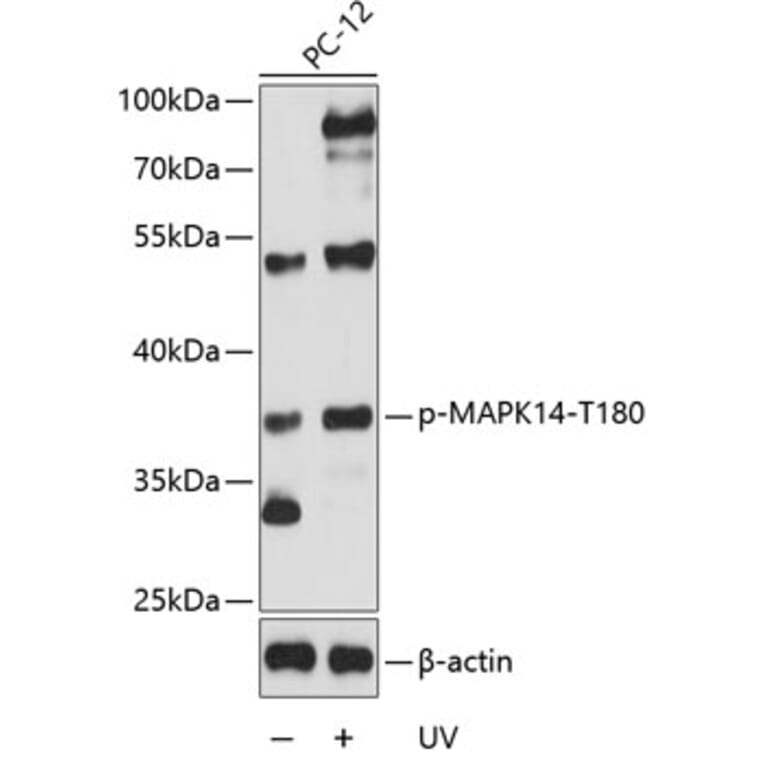 Western Blot - Anti-MAPK14 (phospho T180) Antibody (AP0056) - Antibodies.com