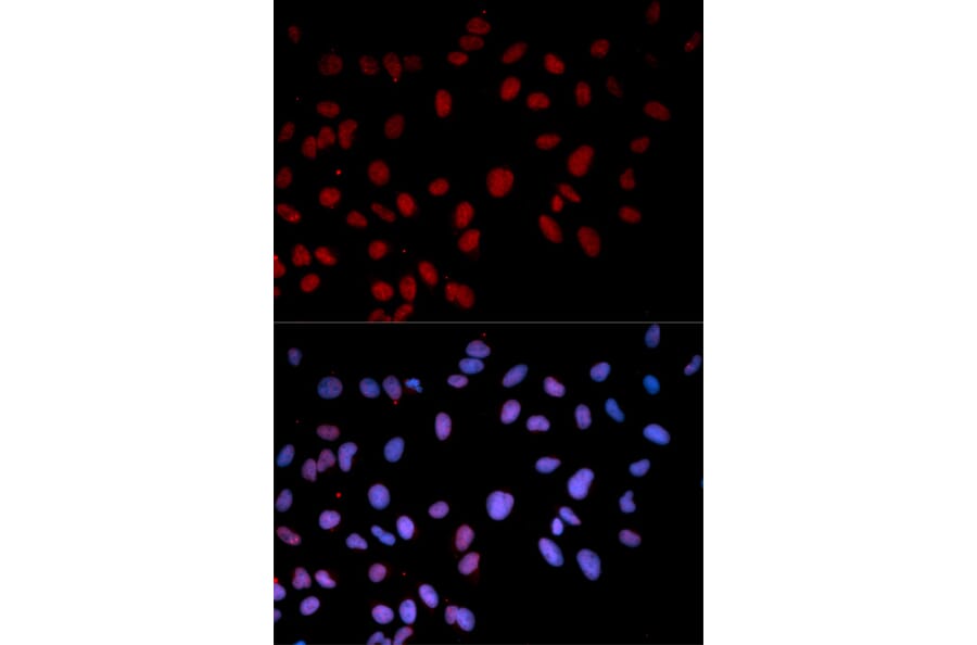 Immunofluorescence - Anti-MAPK14 (phospho T180) Antibody (AP0056) - Antibodies.com