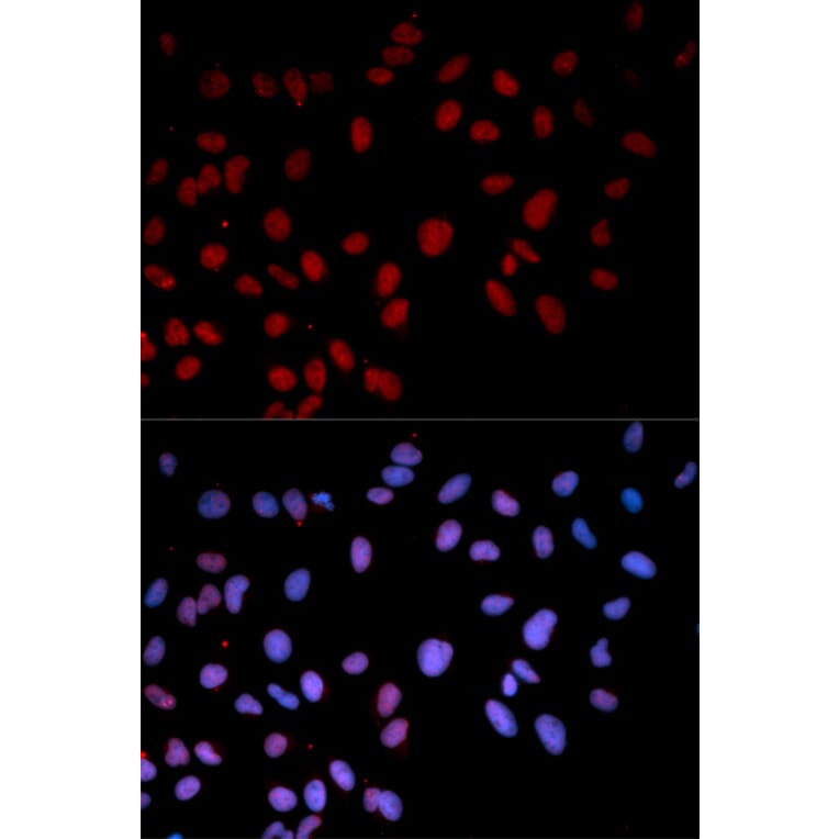 Immunofluorescence - Anti-MAPK14 (phospho T180) Antibody (AP0056) - Antibodies.com