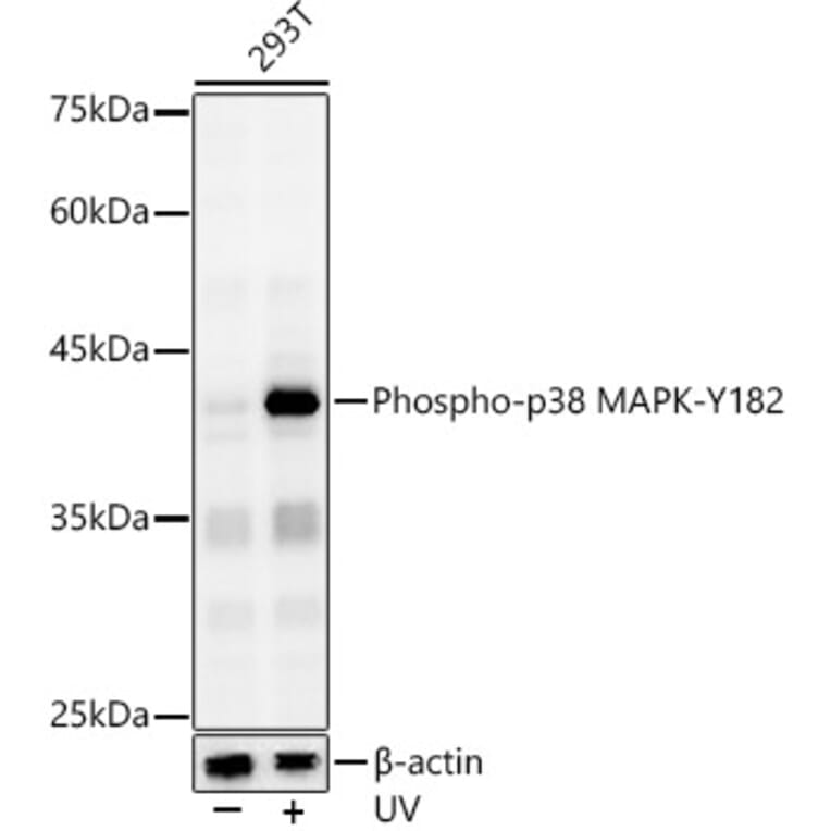 Western Blot - Anti-p38 alpha/MAPK14 (phospho Tyr182) Antibody (A16420) - Antibodies.com