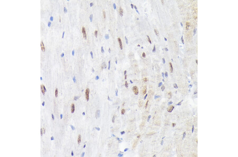 Immunohistochemistry - Anti-p38 alpha/MAPK14 (phospho Tyr182) Antibody (A16420) - Antibodies.com