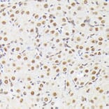 Immunohistochemistry - Anti-p38 alpha/MAPK14 (phospho Tyr182) Antibody (A16420) - Antibodies.com