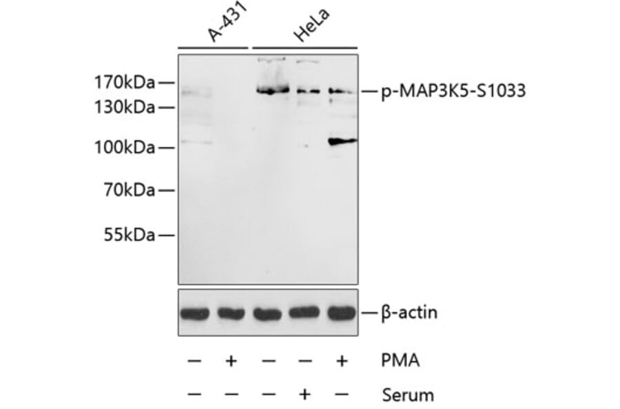 Western Blot - Anti-ASK1 (phospho Ser1033) Antibody (A16421) - Antibodies.com