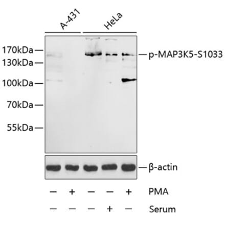 Western Blot - Anti-ASK1 (phospho Ser1033) Antibody (A16421) - Antibodies.com