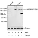 Western Blot - Anti-ASK1 (phospho Ser1033) Antibody (A16421) - Antibodies.com