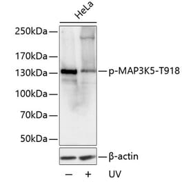 Western Blot - Anti-ASK1 (phospho Thr918) Antibody (A16423) - Antibodies.com