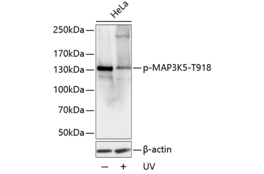 Western Blot - Anti-ASK1 (phospho Thr918) Antibody (A16423) - Antibodies.com