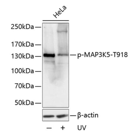 Western Blot - Anti-ASK1 (phospho Thr918) Antibody (A16423) - Antibodies.com