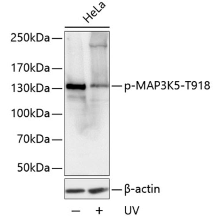 Western Blot - Anti-ASK1 (phospho Thr918) Antibody (A16423) - Antibodies.com