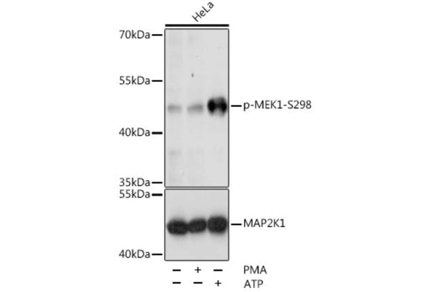 Western Blot - Anti-MEK1 (phospho Ser298) Antibody (A16425) - Antibodies.com