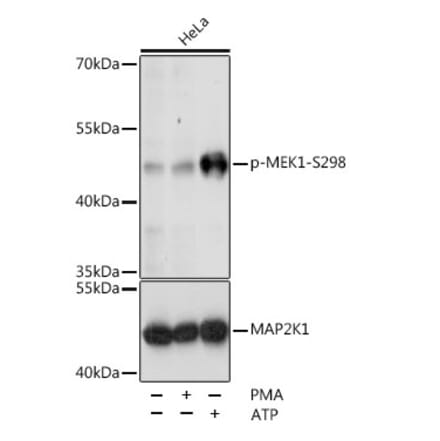 Western Blot - Anti-MEK1 (phospho Ser298) Antibody (A16425) - Antibodies.com