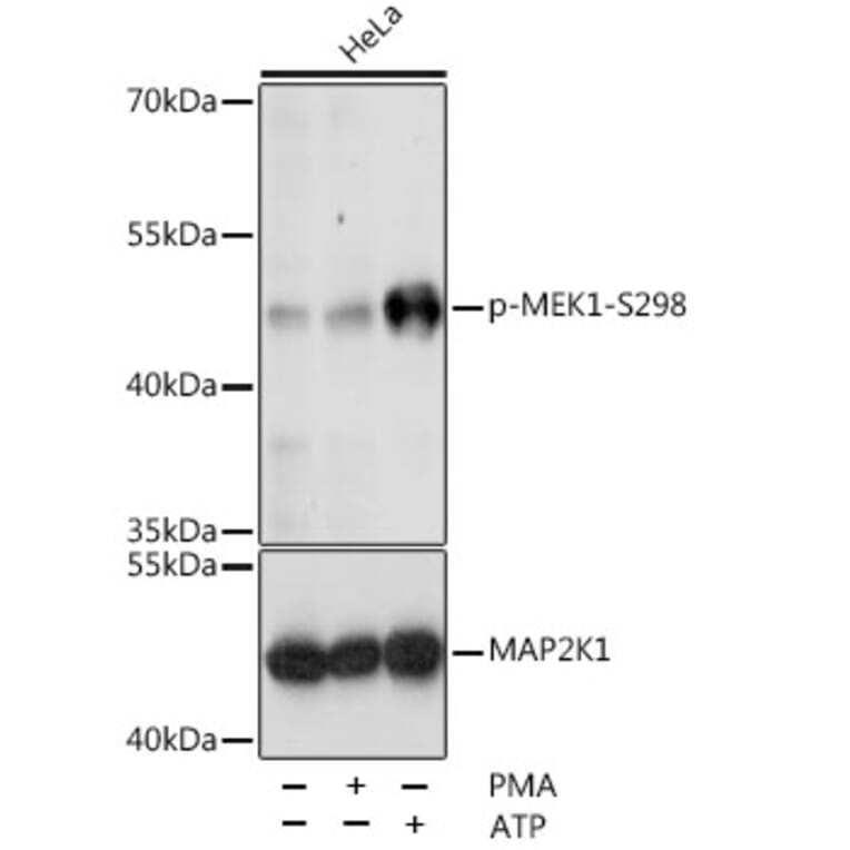 Western Blot - Anti-MEK1 (phospho Ser298) Antibody (A16425) - Antibodies.com