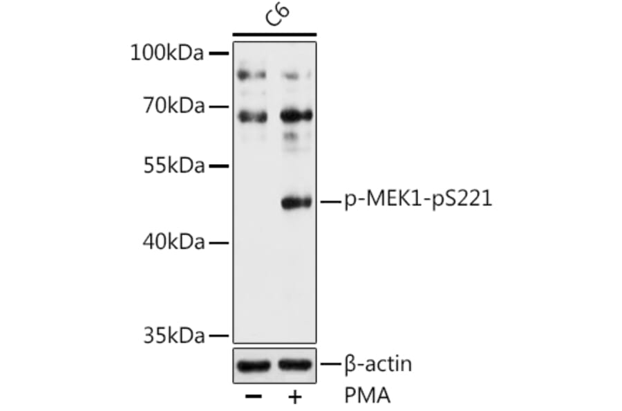 Western Blot - Anti-MEK1 (phospho Ser221) Antibody (A16426) - Antibodies.com