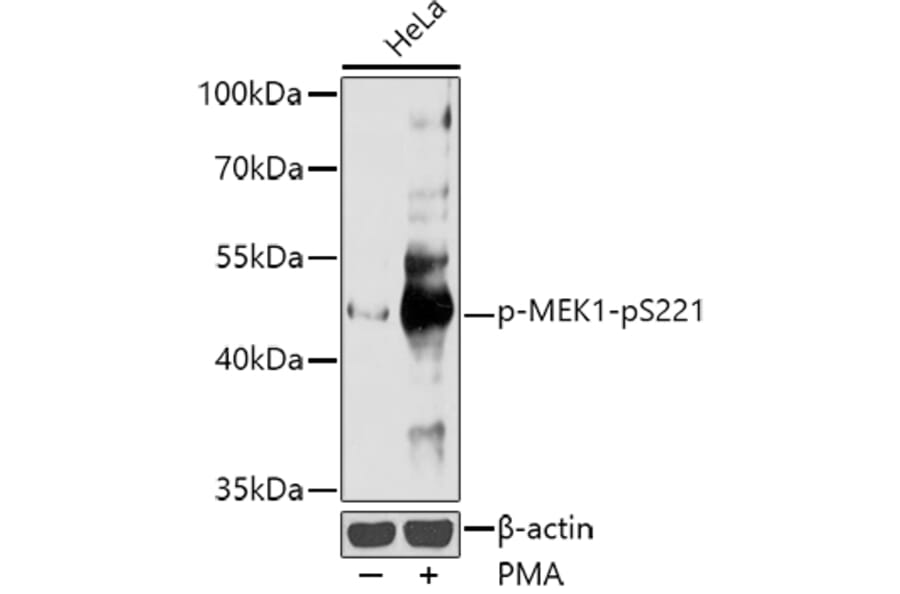 Western Blot - Anti-MEK1 (phospho Ser221) Antibody (A16426) - Antibodies.com