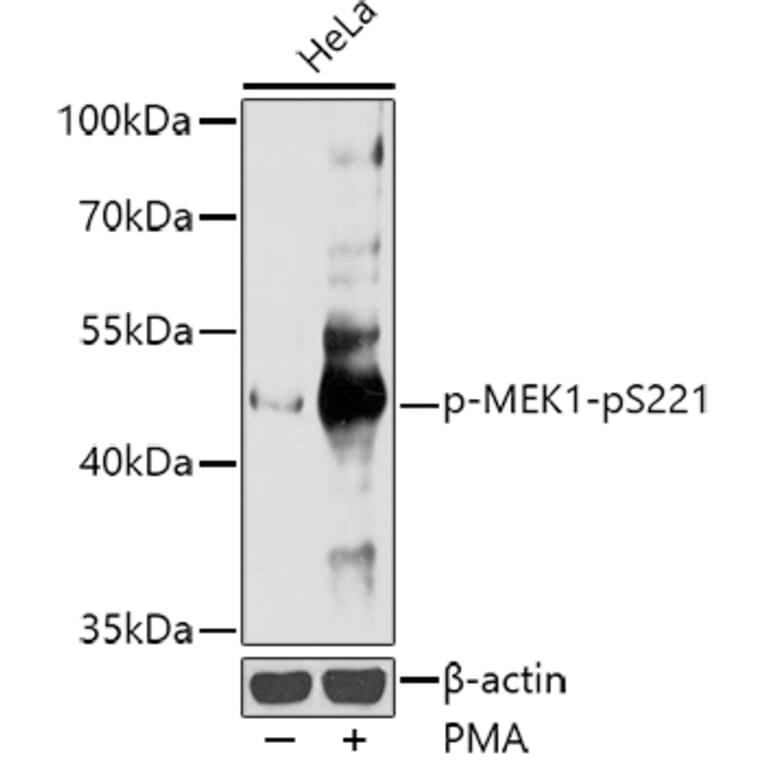 Western Blot - Anti-MEK1 (phospho Ser221) Antibody (A16426) - Antibodies.com