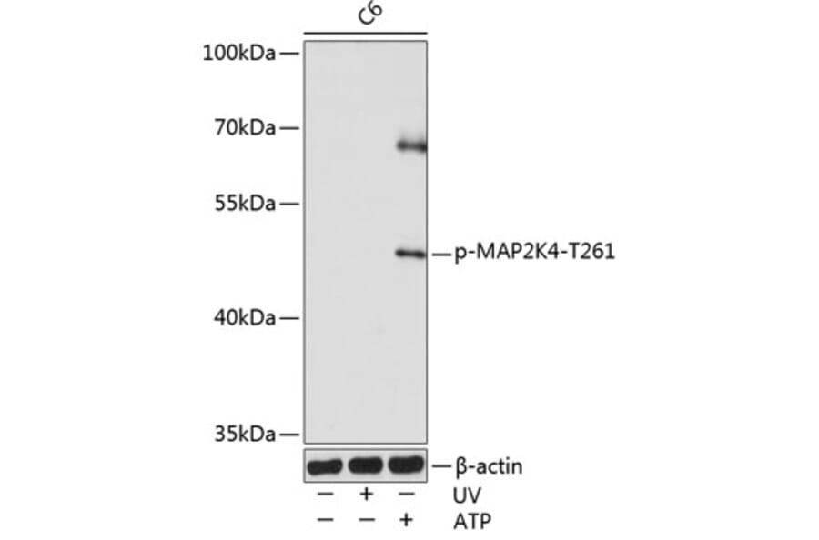 Western Blot - Anti-MEK4/MKK4 (phospho Thr261) Antibody (A16430) - Antibodies.com