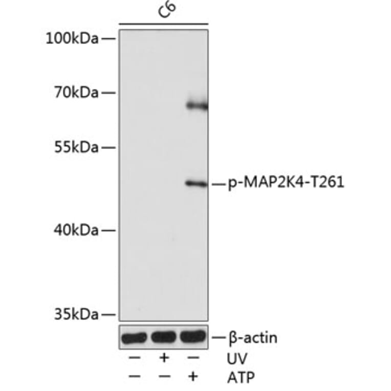 Western Blot - Anti-MEK4/MKK4 (phospho Thr261) Antibody (A16430) - Antibodies.com