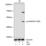 Western Blot - Anti-MEK4/MKK4 (phospho Thr261) Antibody (A16430) - Antibodies.com