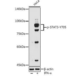 Western Blot - Anti-STAT3 (phospho Tyr705) Antibody (A16431) - Antibodies.com