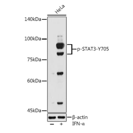 Western Blot - Anti-STAT3 (phospho Tyr705) Antibody (A16431) - Antibodies.com