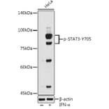 Western Blot - Anti-STAT3 (phospho Tyr705) Antibody (A16431) - Antibodies.com