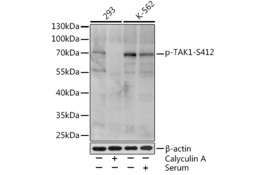 Western Blot - Anti-TAK1 (phospho Ser412) Antibody (A16432) - Antibodies.com