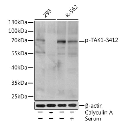 Western Blot - Anti-TAK1 (phospho Ser412) Antibody (A16432) - Antibodies.com