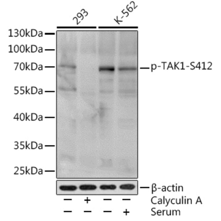 Western Blot - Anti-TAK1 (phospho Ser412) Antibody (A16432) - Antibodies.com