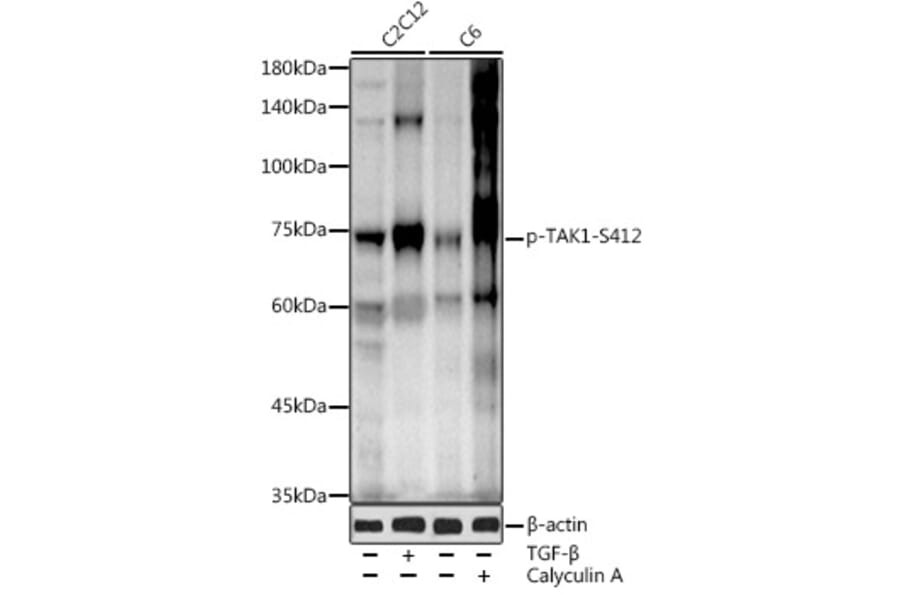 Western Blot - Anti-TAK1 (phospho Ser412) Antibody (A16432) - Antibodies.com