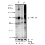 Western Blot - Anti-TAK1 (phospho Ser412) Antibody (A16432) - Antibodies.com