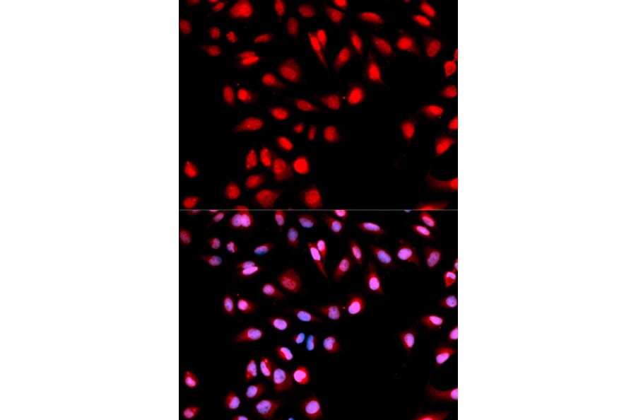 Immunofluorescence - Anti-MET (phospho Y1003) Antibody (AP0076) - Antibodies.com