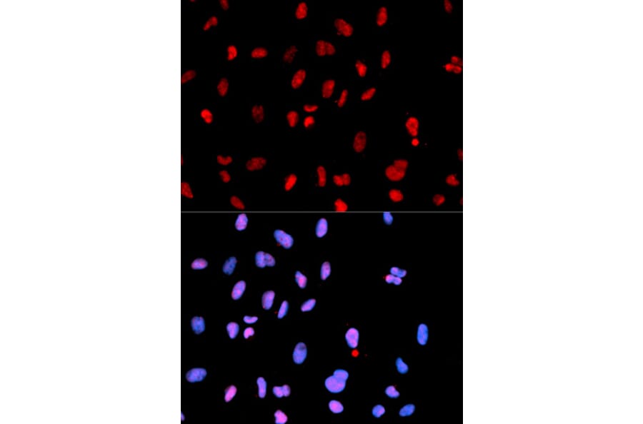 Immunofluorescence - Anti-MET (phospho Y1234) Antibody (AP0078) - Antibodies.com