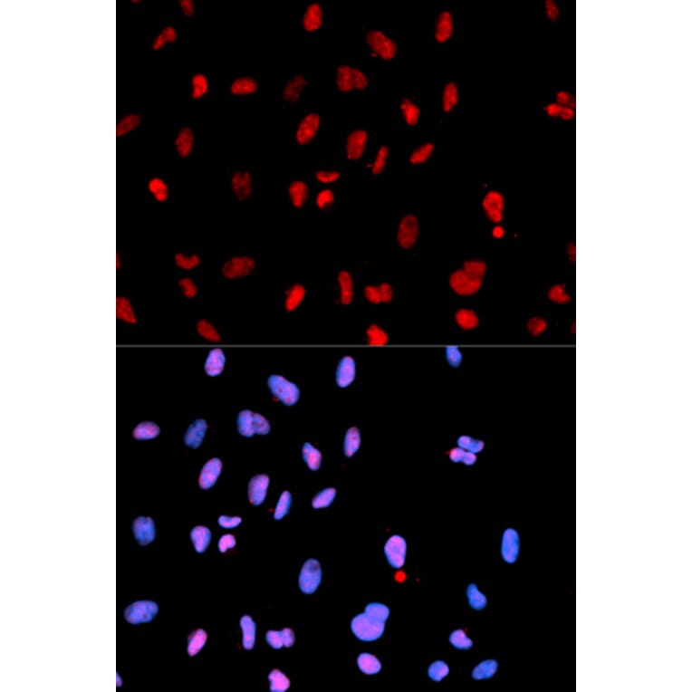 Immunofluorescence - Anti-MET (phospho Y1234) Antibody (AP0078) - Antibodies.com