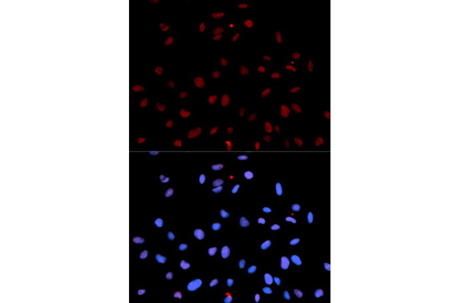 Immunofluorescence - Anti-MET (phospho Y1235) Antibody (AP0079) - Antibodies.com