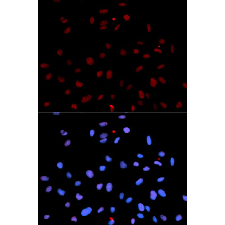 Immunofluorescence - Anti-MET (phospho Y1235) Antibody (AP0079) - Antibodies.com