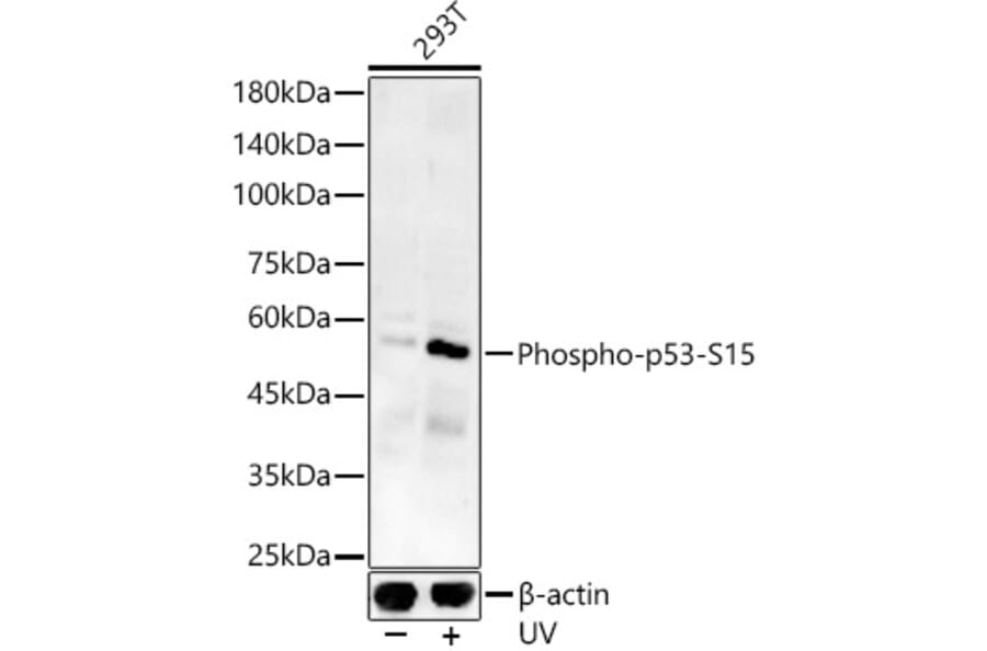 Western Blot - Anti-p53 (phospho Ser15) Antibody (A16438) - Antibodies.com