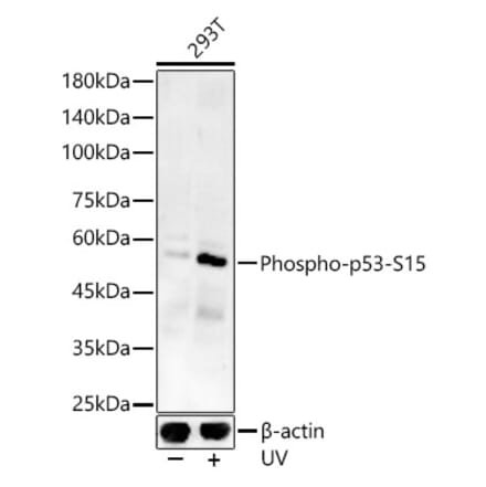 Western Blot - Anti-p53 (phospho Ser15) Antibody (A16438) - Antibodies.com