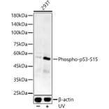 Western Blot - Anti-p53 (phospho Ser15) Antibody (A16438) - Antibodies.com