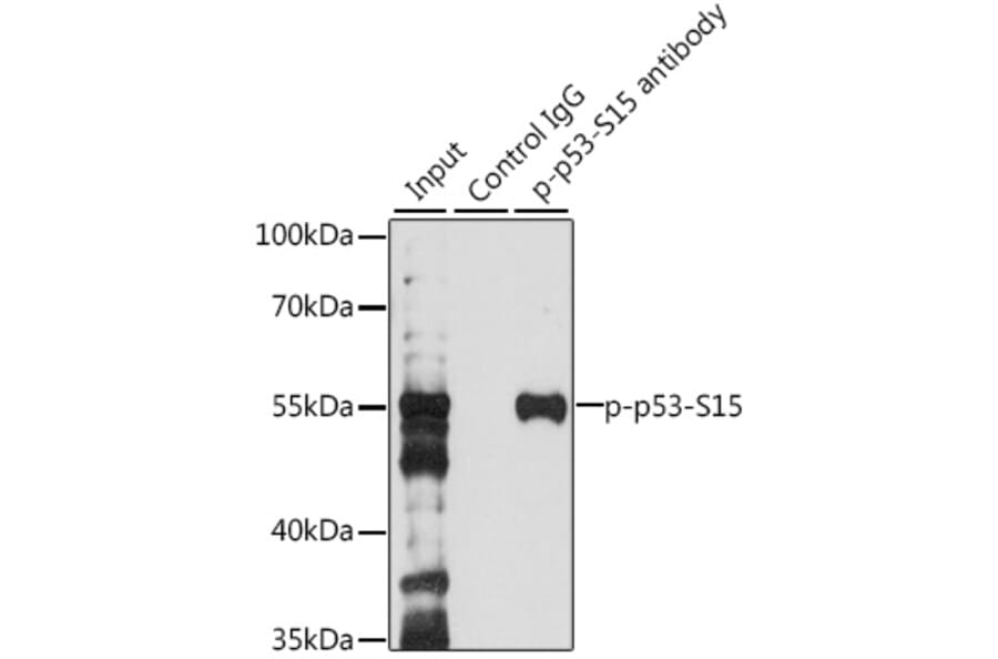 Western Blot - Anti-p53 (phospho Ser15) Antibody (A16438) - Antibodies.com