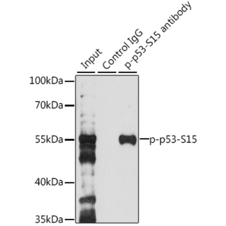 Western Blot - Anti-p53 (phospho Ser15) Antibody (A16438) - Antibodies.com