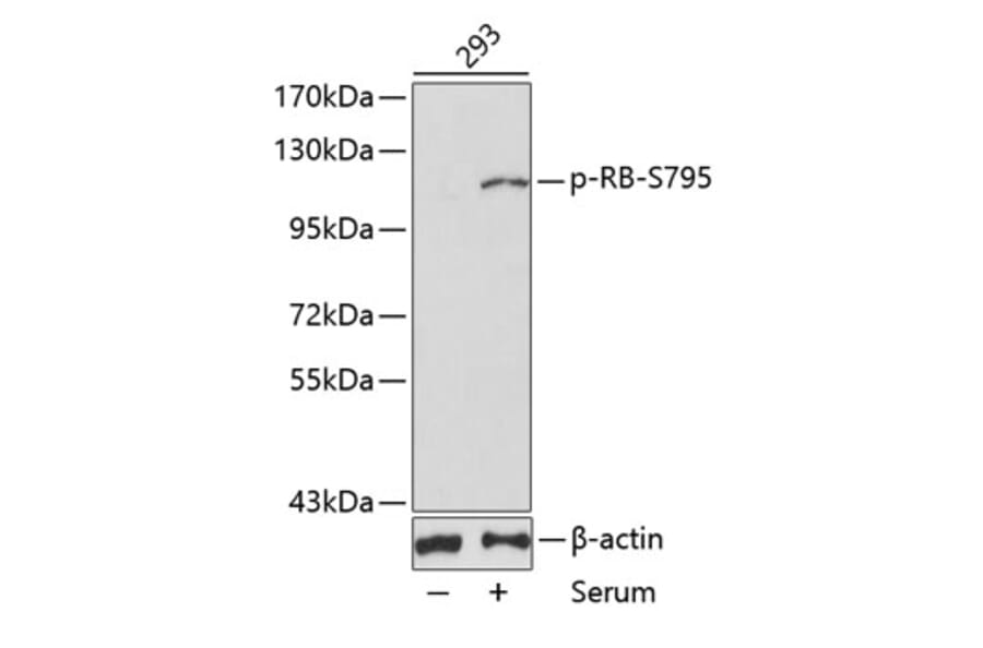 Western Blot - Anti-Rb (phospho Ser795) Antibody (A16439) - Antibodies.com