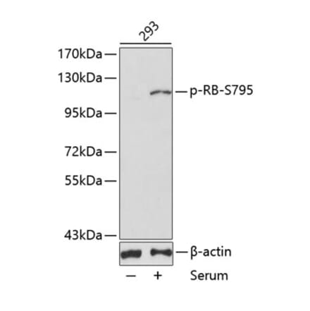 Western Blot - Anti-Rb (phospho Ser795) Antibody (A16439) - Antibodies.com