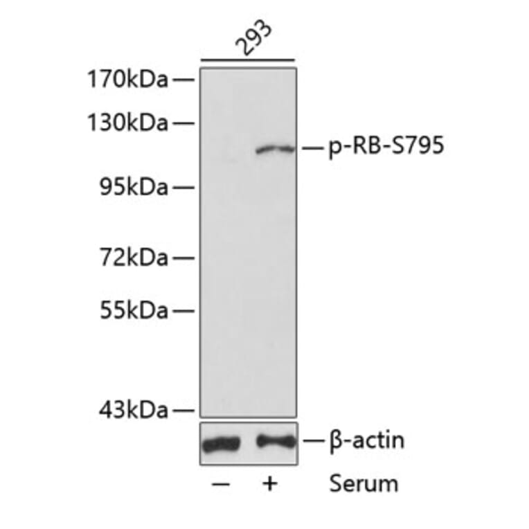 Western Blot - Anti-Rb (phospho Ser795) Antibody (A16439) - Antibodies.com
