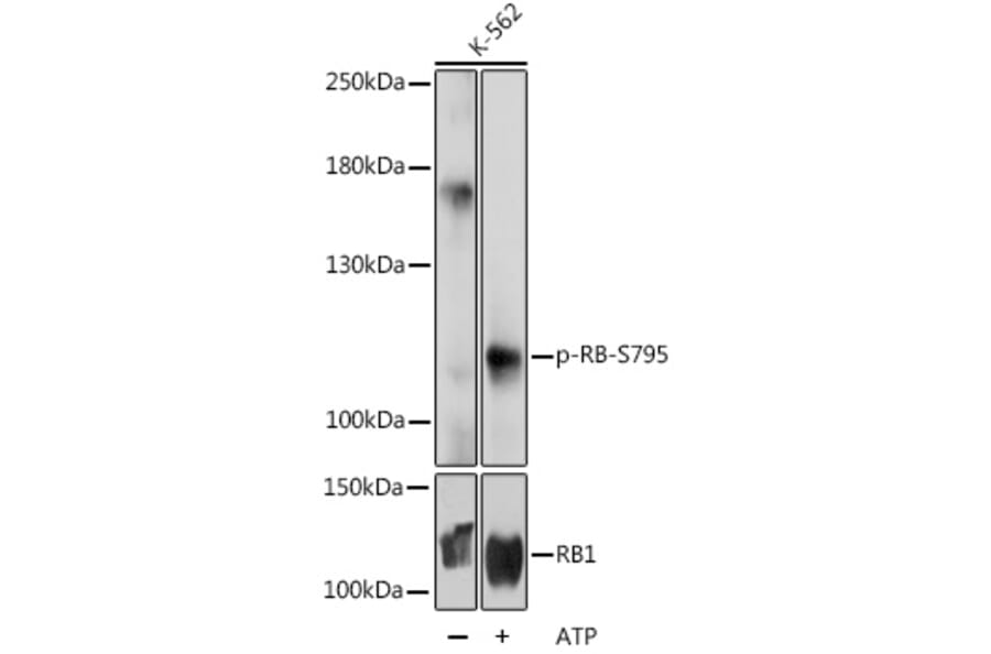 Western Blot - Anti-Rb (phospho Ser795) Antibody (A16439) - Antibodies.com