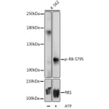 Western Blot - Anti-Rb (phospho Ser795) Antibody (A16439) - Antibodies.com
