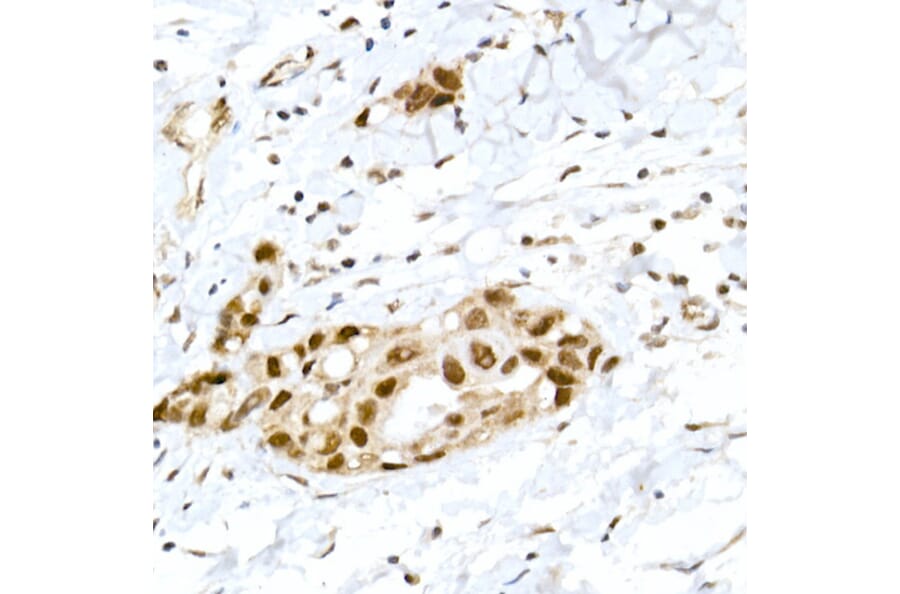 Immunohistochemistry - Anti-Rb (phospho Ser795) Antibody (A16439) - Antibodies.com