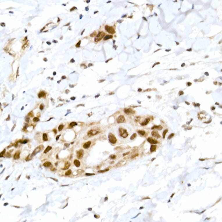 Immunohistochemistry - Anti-Rb (phospho Ser795) Antibody (A16439) - Antibodies.com