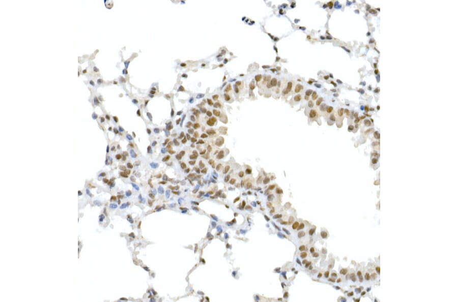 Immunohistochemistry - Anti-Rb (phospho Ser795) Antibody (A16439) - Antibodies.com